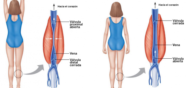 como se originan las varices colas en venezuela