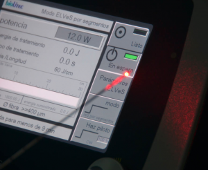 cirugía láser para várices cirugía láser para várices