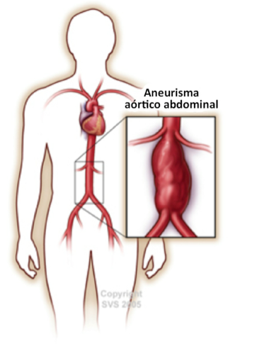 cirujano vascular en caracas