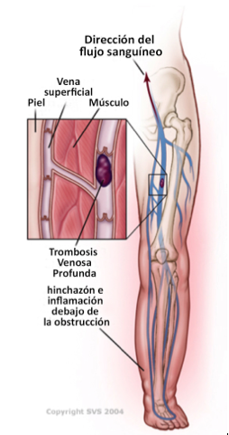 CIRUJANO VASCULAR EN CARACAS