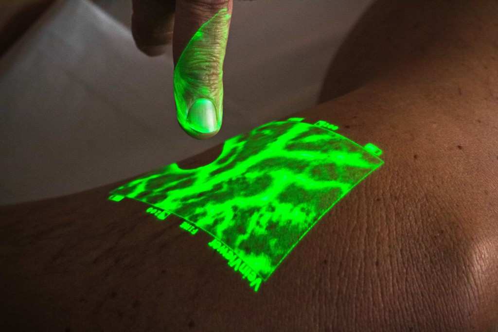 realidad aumentada para tratar varices caracas